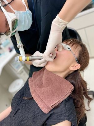 ナイトレーズ プレミアムの照射の様子。保護ゴーグルを着用し、開口器で口を開けた状態で軟口蓋へ照射する
