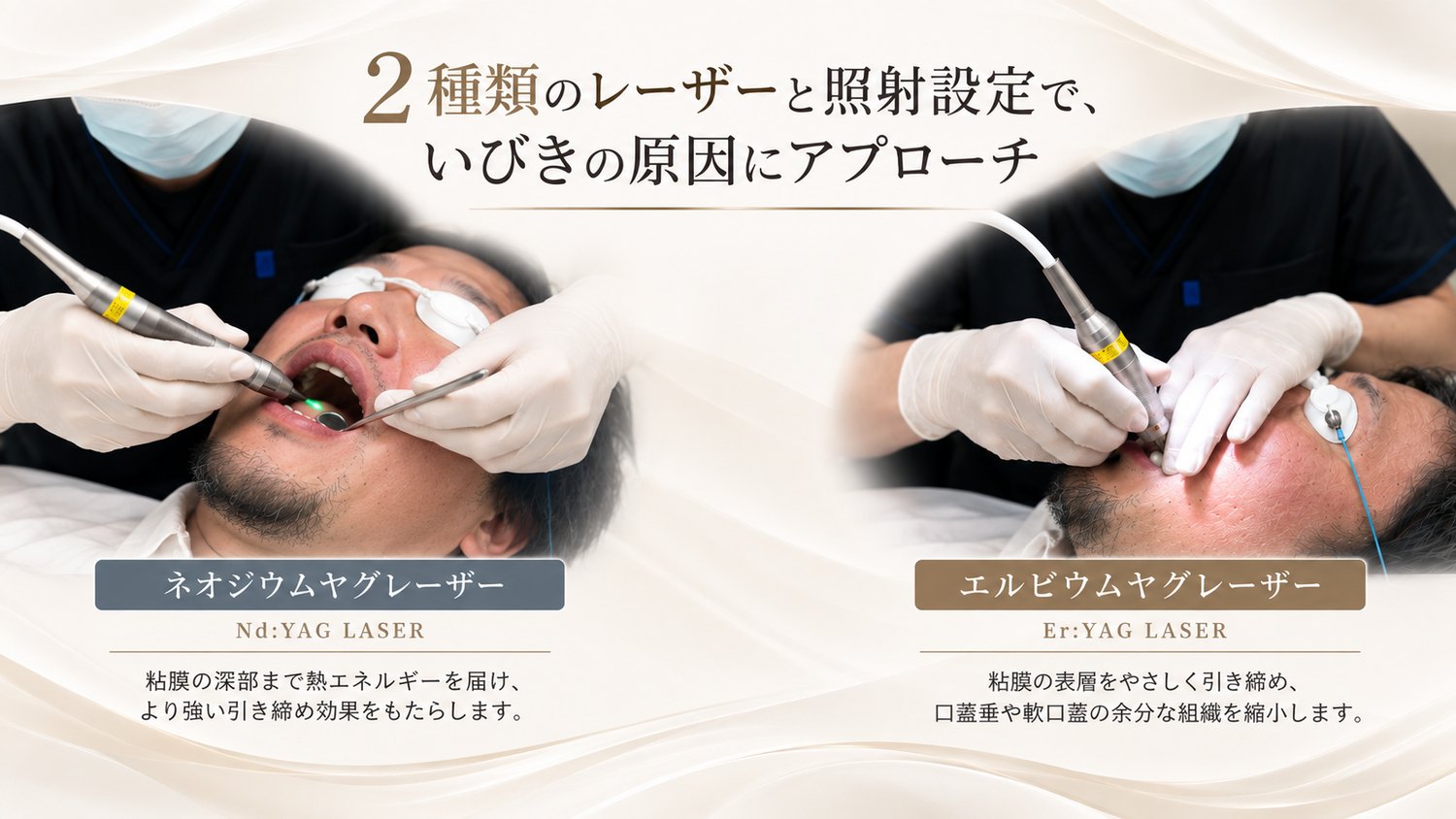 ナイトレーズ プレミアムで使う2種類のレーザー。ネオジウムヤグレーザー（Nd:YAG）は粘膜の深部まで熱エネルギーを届け、エルビウムヤグレーザー（Er:YAG）は粘膜の表層を引き締め、口蓋垂や軟口蓋の組織を縮小する